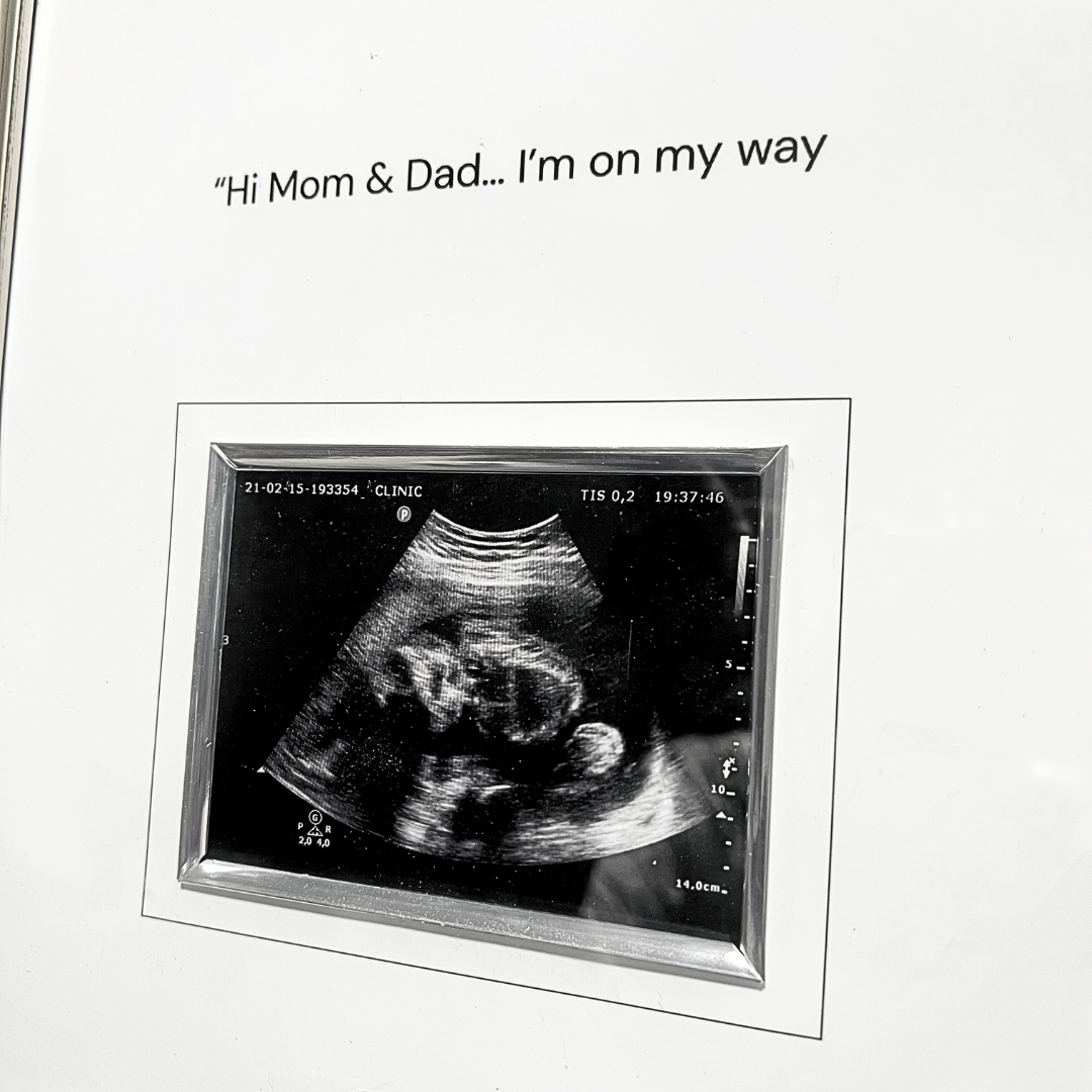 Baby Ultrasound Memory Frame - Precious Keepsake for Forever